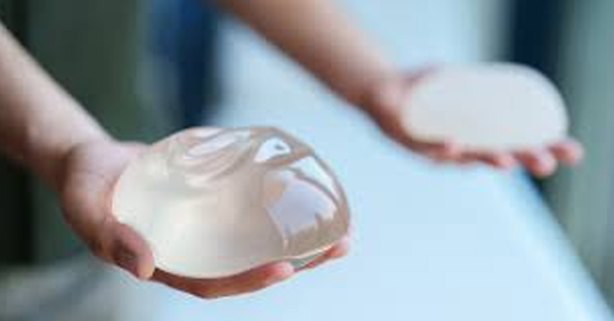 Can breast implants last 30- 40 years?