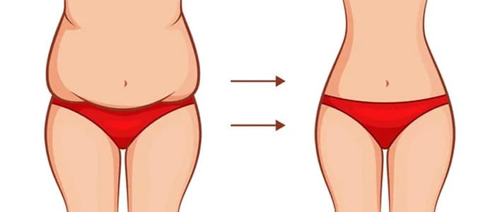 how long is tummy tuck recovery