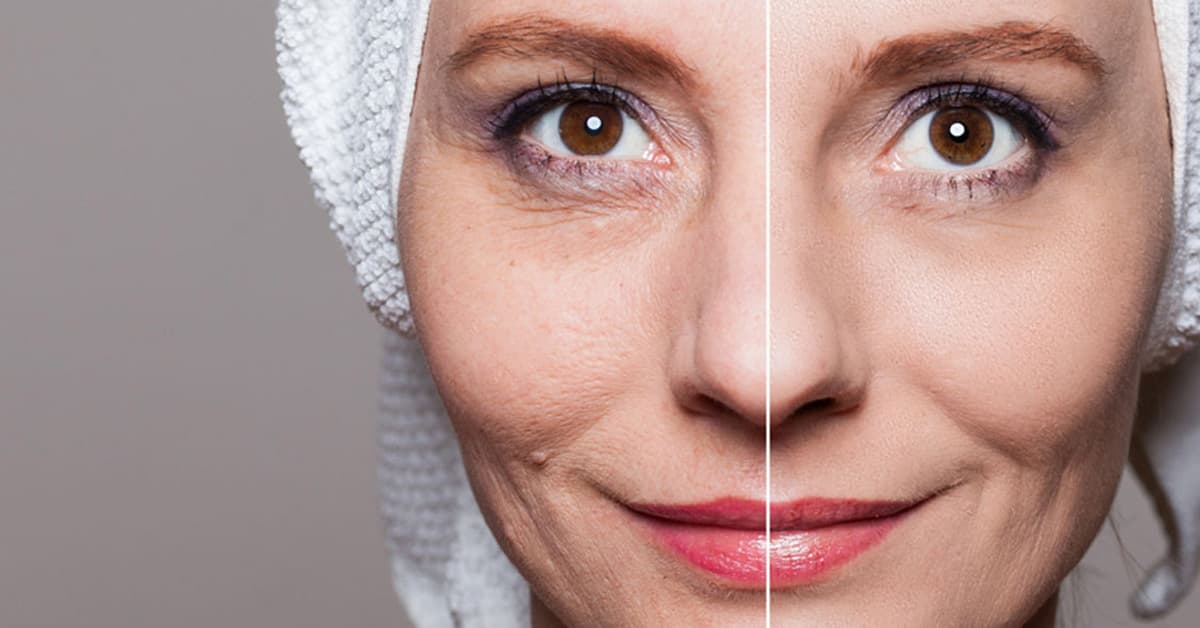 Skin Rejuvenation Methods