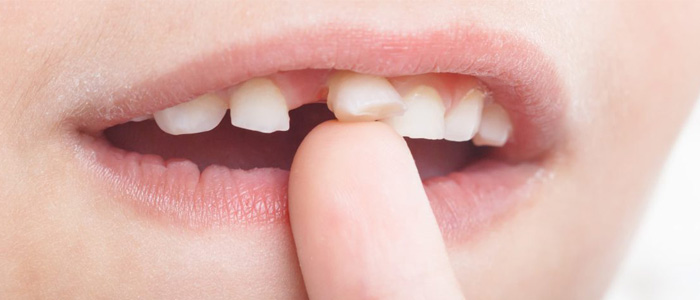 What are some treatments for adult loose teeth?