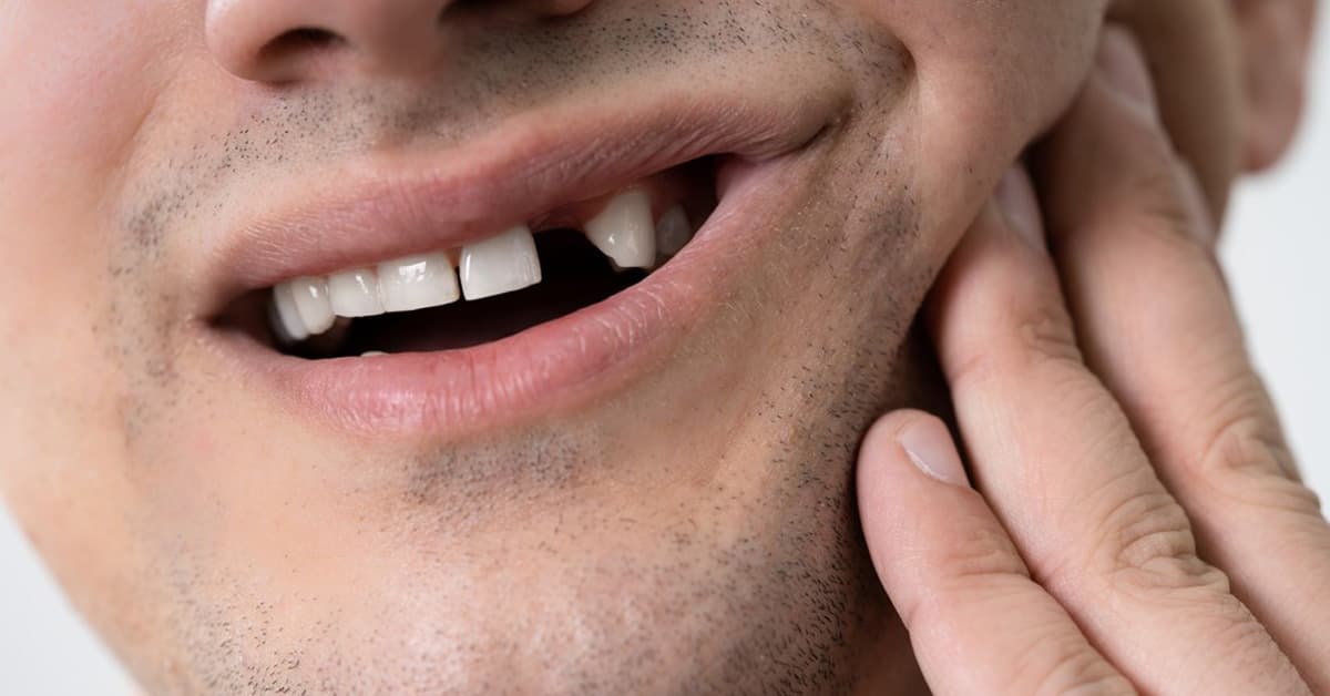 What should you do for loose teeth?