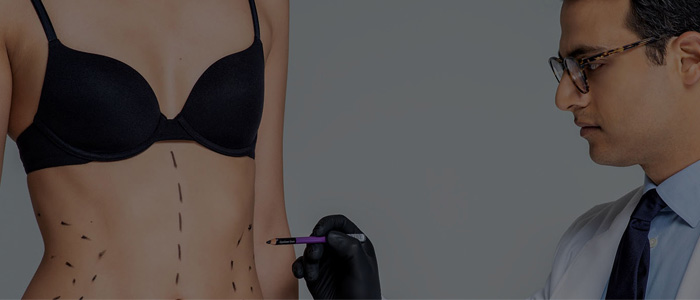 Who is the ideal candidate for tummy tuck?