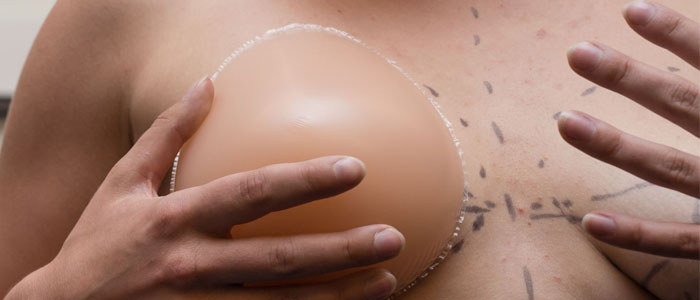 how is breast reconstruction is done